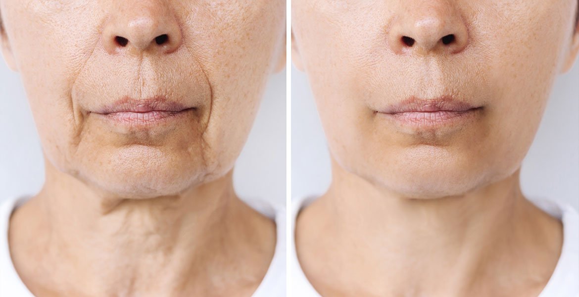 Mulher branca da esquerda com bigode chinês e do lado direito sem bigode chinês
